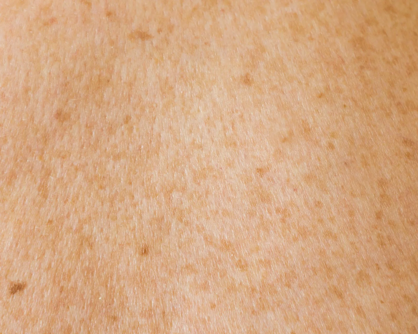 Scar tissue · before treatment