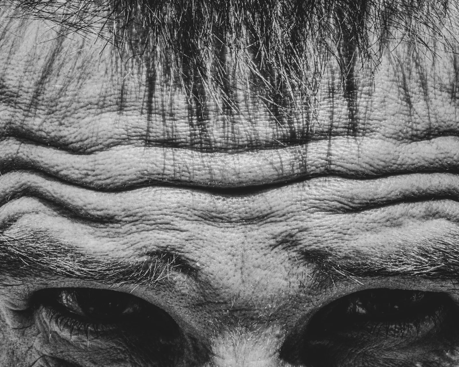 Forehead study · oberes Drittel